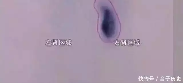女子人在自己家，隔天肾竟不翼而飞，医生看完片子脸色大变中国一场败仗，上万士兵尸体一夜消失，多年后离奇多了“一层塔”