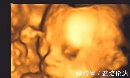 四维彩超|孕期,若胎宝宝有这3个“表现”,可能是个“高智商”宝宝,恭喜