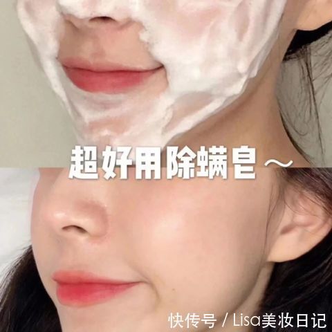 脸颊|皮法师家的它帮你轻松搞定螨虫