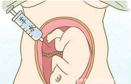 孕妈|怀孕期间,孕妈缺水身体会发出三个信号,要及时补水