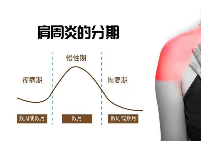 疼痛期|肩周炎患者警惕五大误区，以免病程增长多遭罪