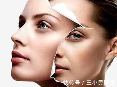 拉皮手术 为什么拉皮手术成为了很多人的选择?