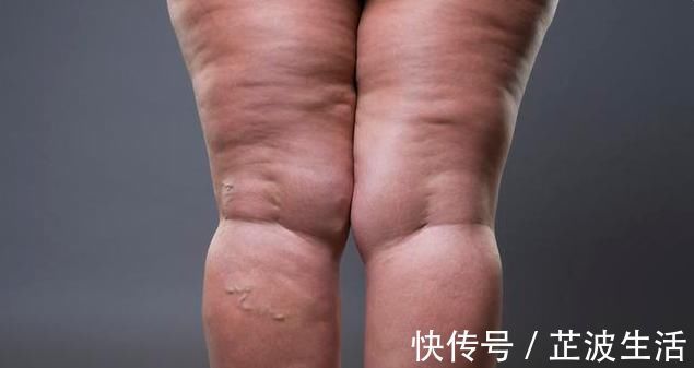 血压|血压高不代表是高血压，高血压6个症状，看看你都了解么