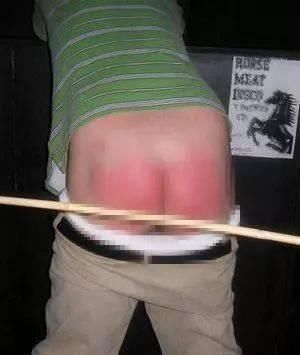 苏子油|9岁男孩排不出尿,查出肾衰,医生说孩子这几处不能随便打