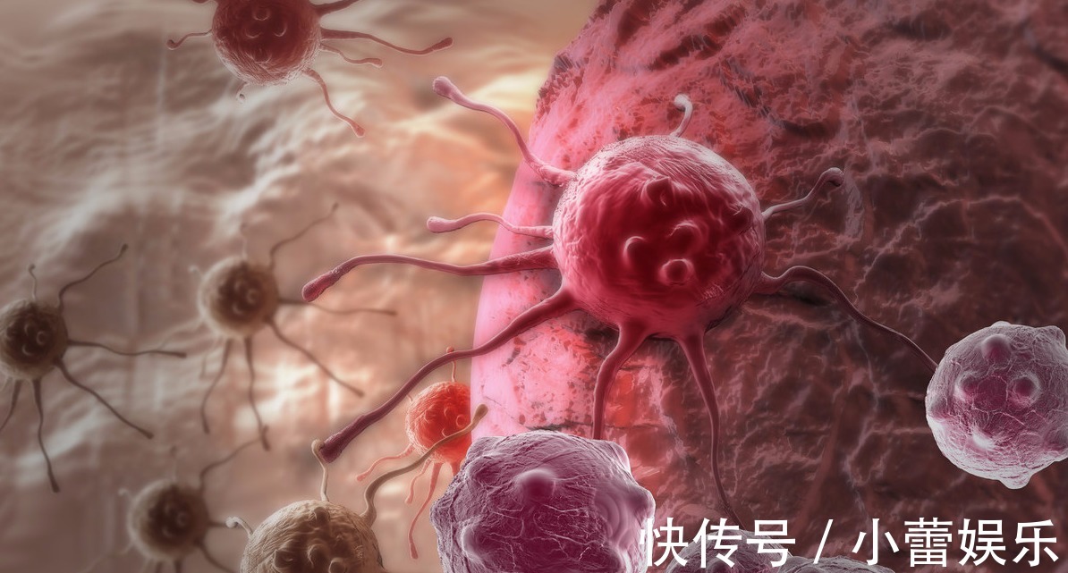 何裕民|23岁小姑娘患上癌症,因为害怕,离开人世,不要死于无知