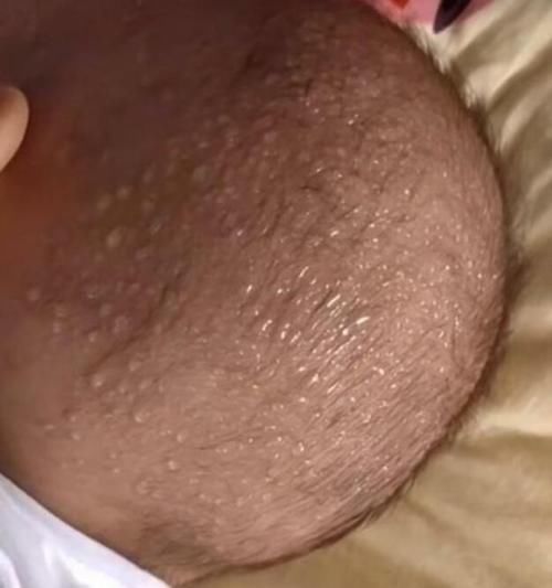 饺子馆|吃一次相同于半月不消化，父母还在喂孩子吃，医生：脾都烂完了