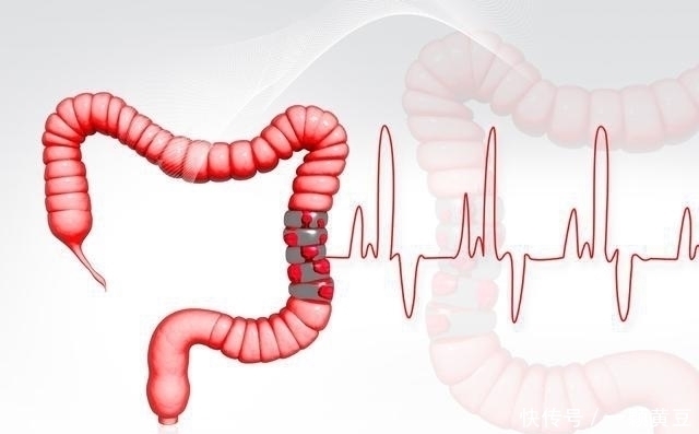 净肠草|这2类食物是天然“泻药”,空腹食快速通便,肠子通,便秘消失!