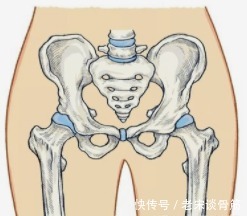 疾病|股骨头坏死中药保守治疗恢复后还会复发吗?