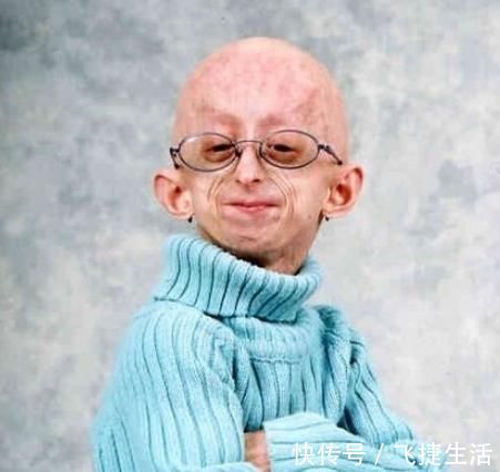 喝酒|加速衰老的“根源”不是年龄,也不是熬夜喝酒,排第一的别再忽视