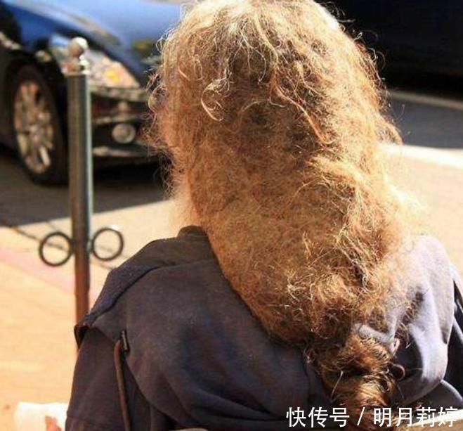 16岁女孩长期“不剪头发”,身体出现这变化,女生请务必了解!