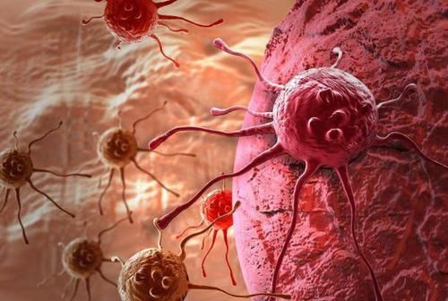 癌变|近期右肩膀莫名疼痛,可能是癌症发出的信号,当心肝癌来报道