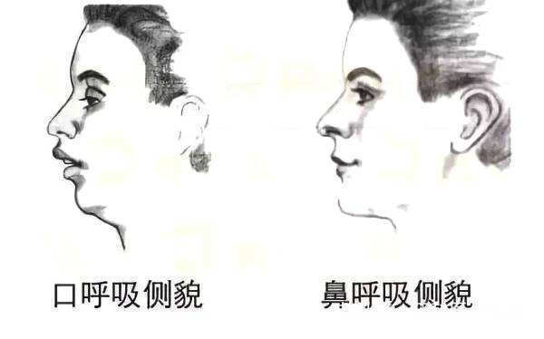 牙齿|会影响孩子牙齿发育和颜值的八大坏习惯,建议尽早戒掉!