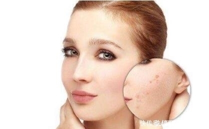 恢复|护肤淡疤的几大误区,几乎人人都会犯!想恢复完美肌肤得这样做