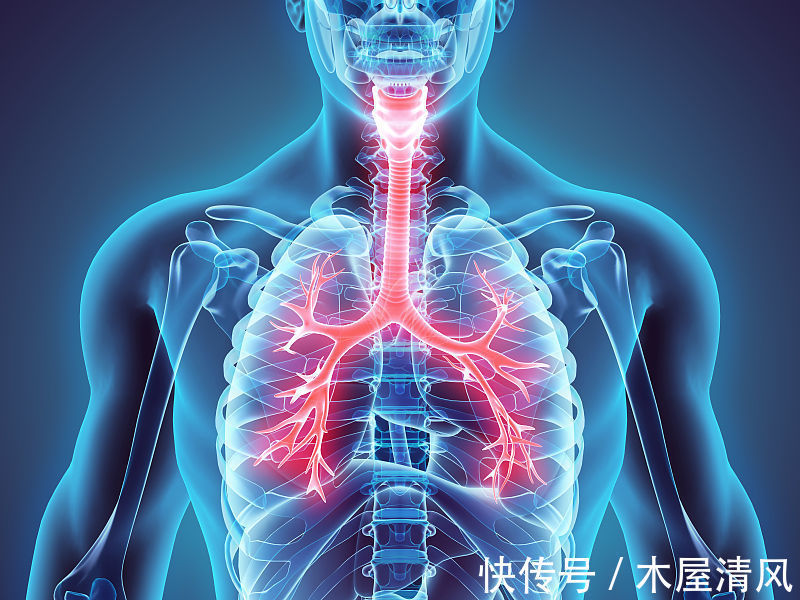 咳嗽|患感冒易转成支气管炎 避免慢性治及时治疗