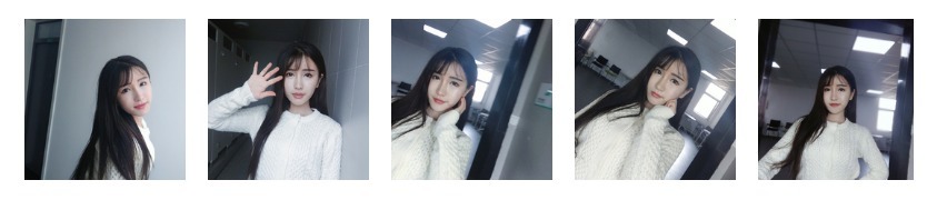 开眼角前后对比照效果图67天记录日记-焦作完美俪人案例