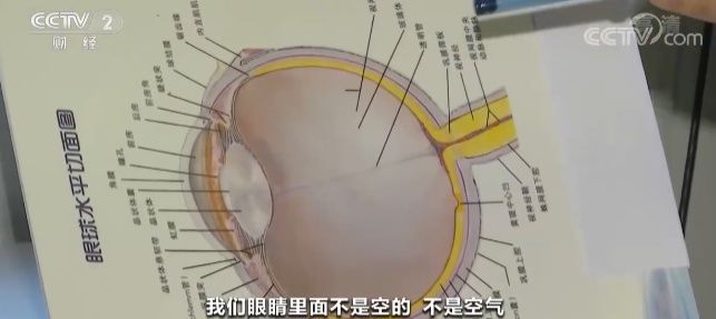 非甾体类|长期错用眼药水 10岁男童患青光眼几近失明