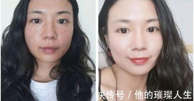 美白|红霉素软膏加它涂抹脸部,不出15天淡斑又美白,赶紧去备上一支!