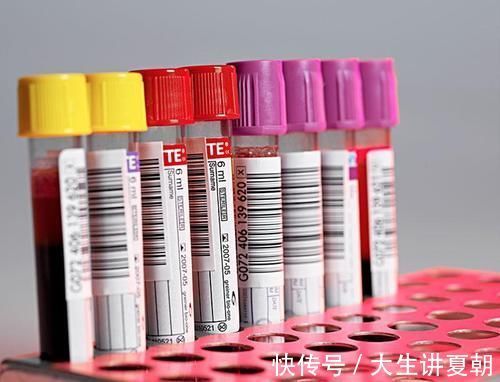 回事|血常规检查，这3个指标别不当回事，身边小事或与健康息息相关