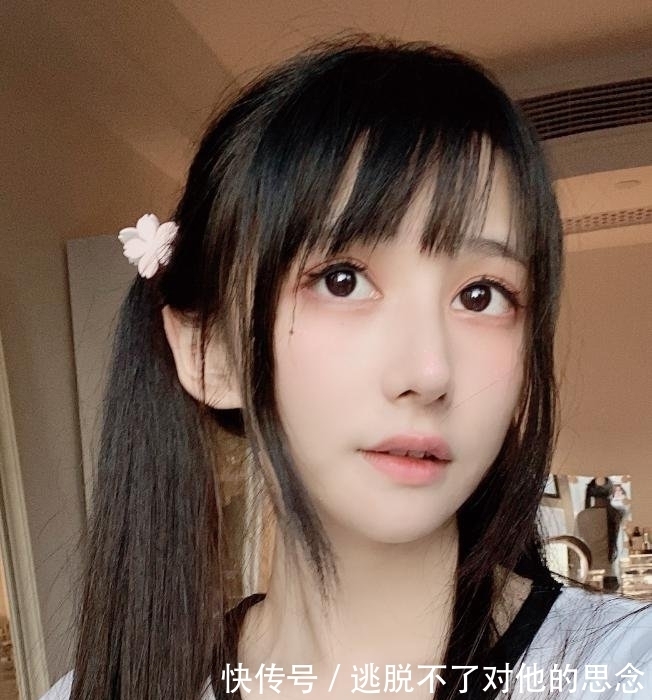 脱发 蔡萝莉真的是一姐?出现秃头危机后,花10多万植发