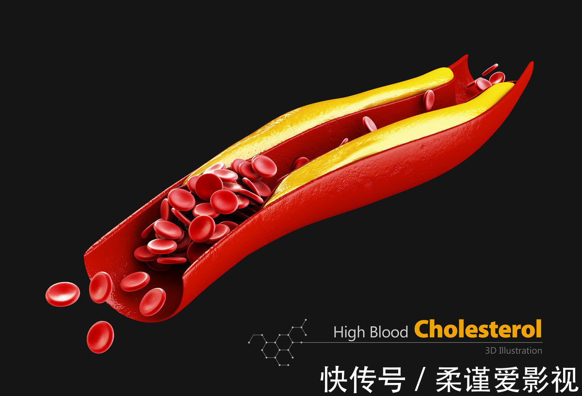 三高|远离高血压、高血糖、高血脂“三高”的15句话,再忙也要看一看