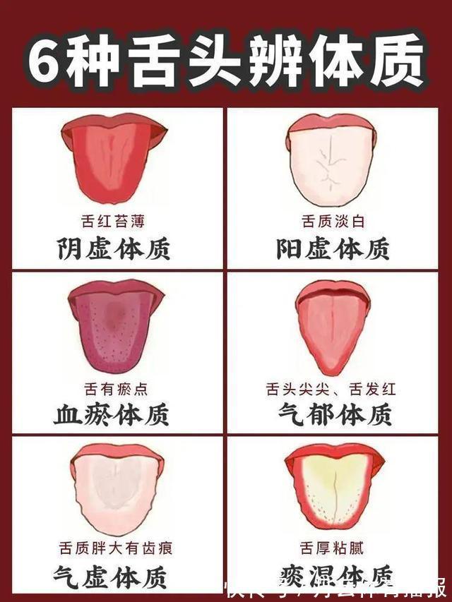 舌头|老中医告诉你，舌头什么样，直接影响健康，每个人都应自查一下