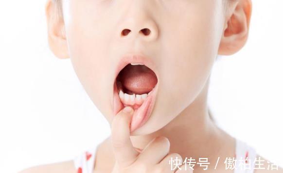 晚点|家长知道孩子换牙时间吗？不要大意了，做好这几点让孩子牙齿变好