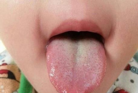 孩子|6岁女娃查出脾胃衰竭,医生:煮粥常放它,脾胃怎能“扛”的住