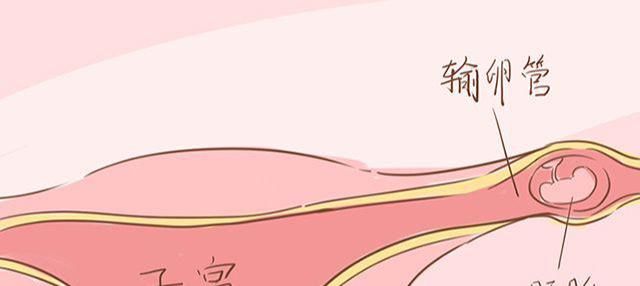 概率|生活中，这3件事女性不能大意，不然怀孕时可能会很危险