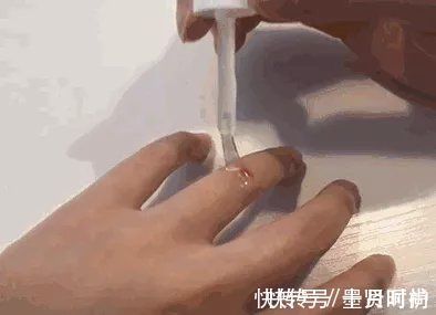 手指|三岁女童被活活截断手指,终生残疾!只因用错创可贴,快自查