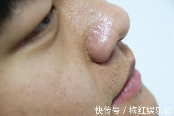 肝脏健康|肝脏的“解毒帮手”，不是大蒜，清肝护肝，经常吃，让肝更干净