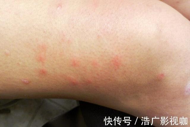 健康|口腔溃疡、胃反酸,11种常见的健康小问题都能用盐解决,天然无害