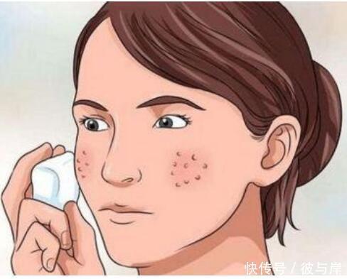 辣椒是留痘印的“罪魁祸首”?不敢吃辣椒的人都过来看看吧