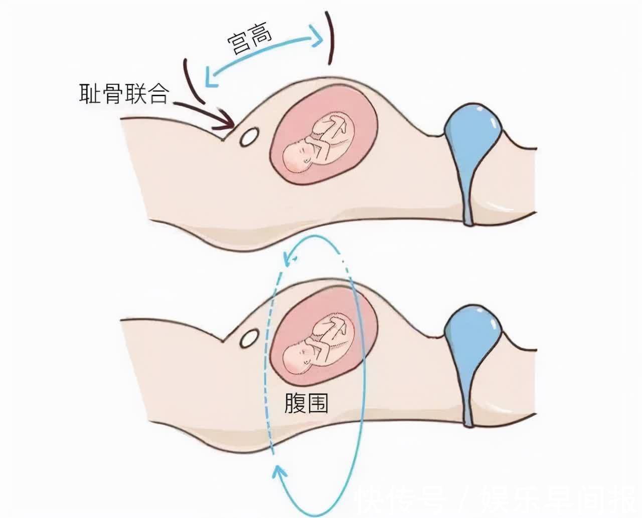 宫缩|胎儿入盆有哪些症状？有经验的老人一看、二摸就知道胎儿是否入盆