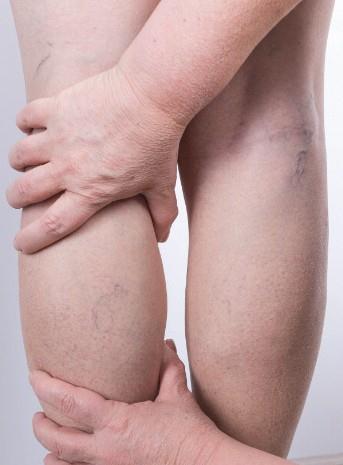 浮肿|小孩子总是咳嗽有什么好方法?腿部一到下午就浮肿是什么原因?