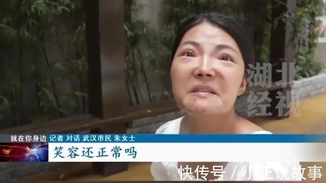 医生 女子整容失败,说好的明星同款鼻子,术后直言笑都很困难!