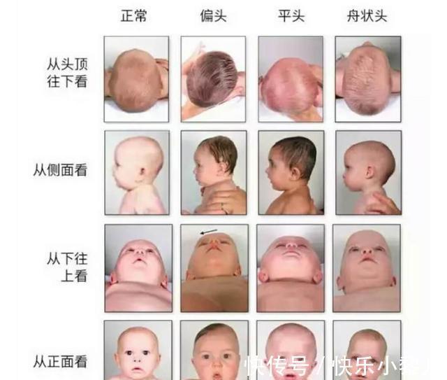 孩子|宝宝“头型”决定未来身高？并非乱说，这种头型往往不会低
