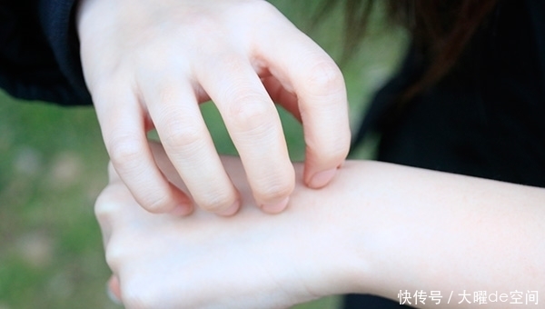 红霉素软膏竟然有这么多的用处,你知道怎么用吗?