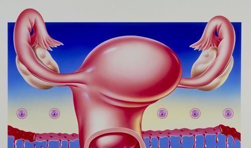 子宫|什么是子宫肌瘤？在哪种情况下才需要切掉子宫？