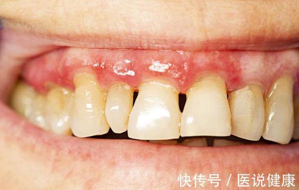 便秘|男人衰老时,身体机能开始下降,出现这5种表现,需注意保养