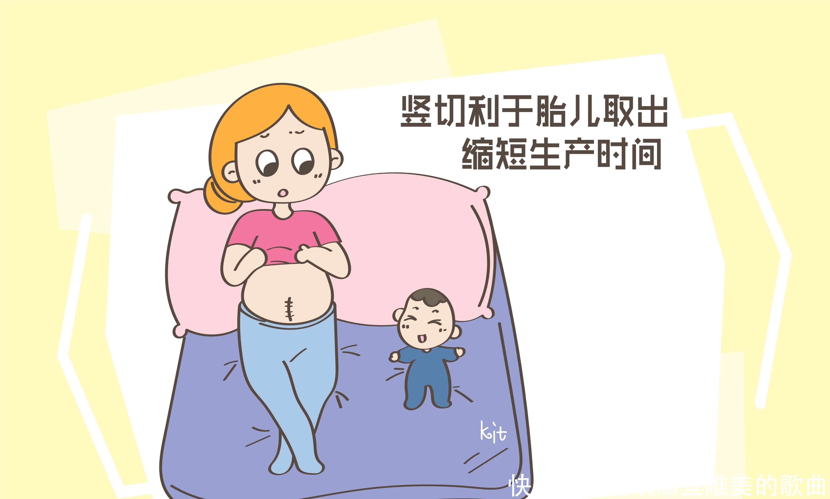 选择|不能顺产只能选择剖腹产,是竖切还是横切要多多考虑