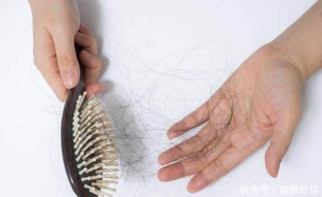 提醒:头上有螨虫的人,可能会有4种表现,别忽视了!