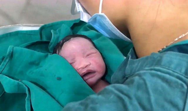 乳白色|新生儿全身涂满“猪油”,母子相见吓坏产妇医生这是好事