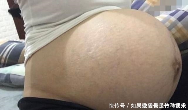 胎儿|怀孕晚期,如何判断“要生了”?3个方法要牢记,别把孩子生家里