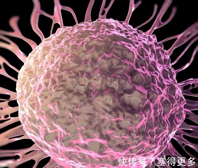 癌症|肿瘤切除后,为何还复发?肿瘤专家一席话,胜过自己摸索5年