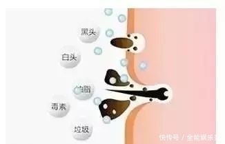 粗大|毛孔粗大问题多?教你5招快速收缩毛孔