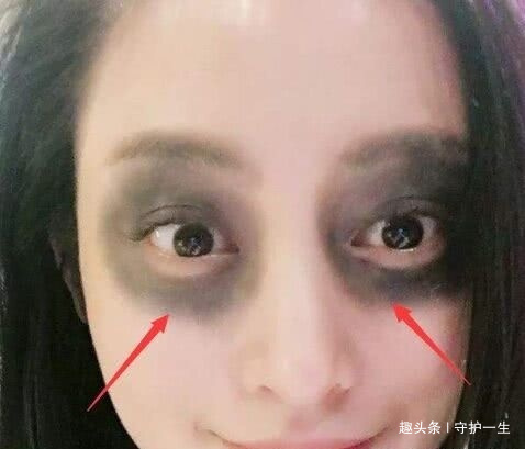 妇科疾病|子宫“脏兮兮”的女孩,脸上会有“3异常”,若一个未中,恭喜咯