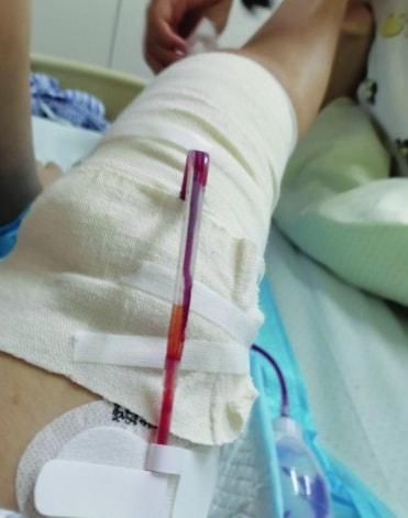 夏夏|“得了癌症是怎样的经历?”00后女孩分享抗癌故事,网友:破防了……