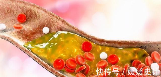 体检|70岁老人血压、血脂、血糖一直都正常，反而还不好，为什么？