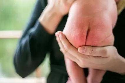 宝宝红屁股、长湿疹了，怎么办？事关孩子的发育，可别乱用婴儿霜