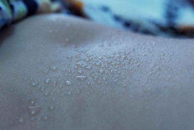 黄芪|出汗里藏有大学问12种出汗,位置不同,症状各异,你是哪种